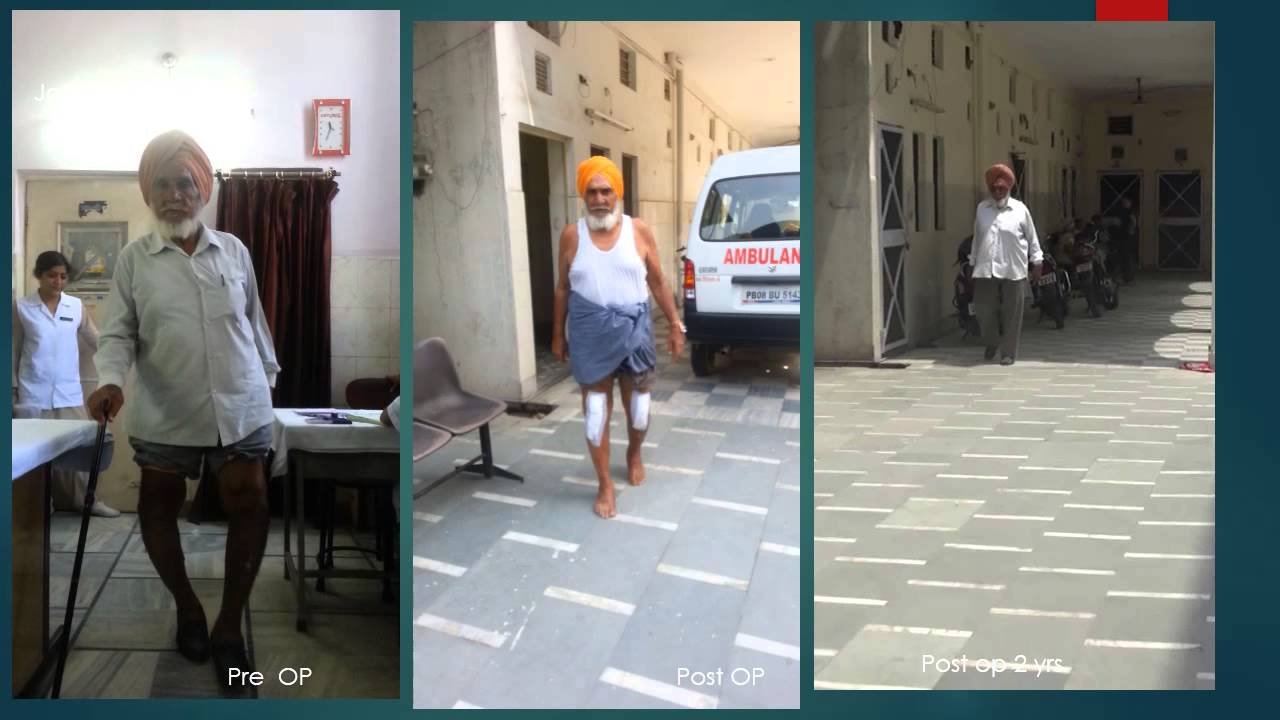 knee joint replacement in jalandhar