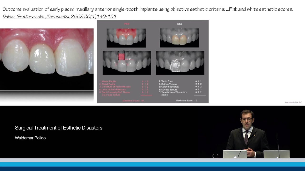 Surgical Treatment of Esthetic Disasters | Waldemar Daudt Polido