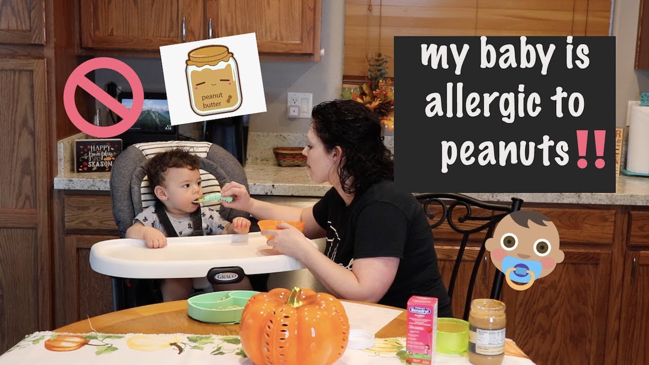 My baby is allergic to peanuts!! // 1st time trying Peanut Butter // Nurse takes her baby to the ER