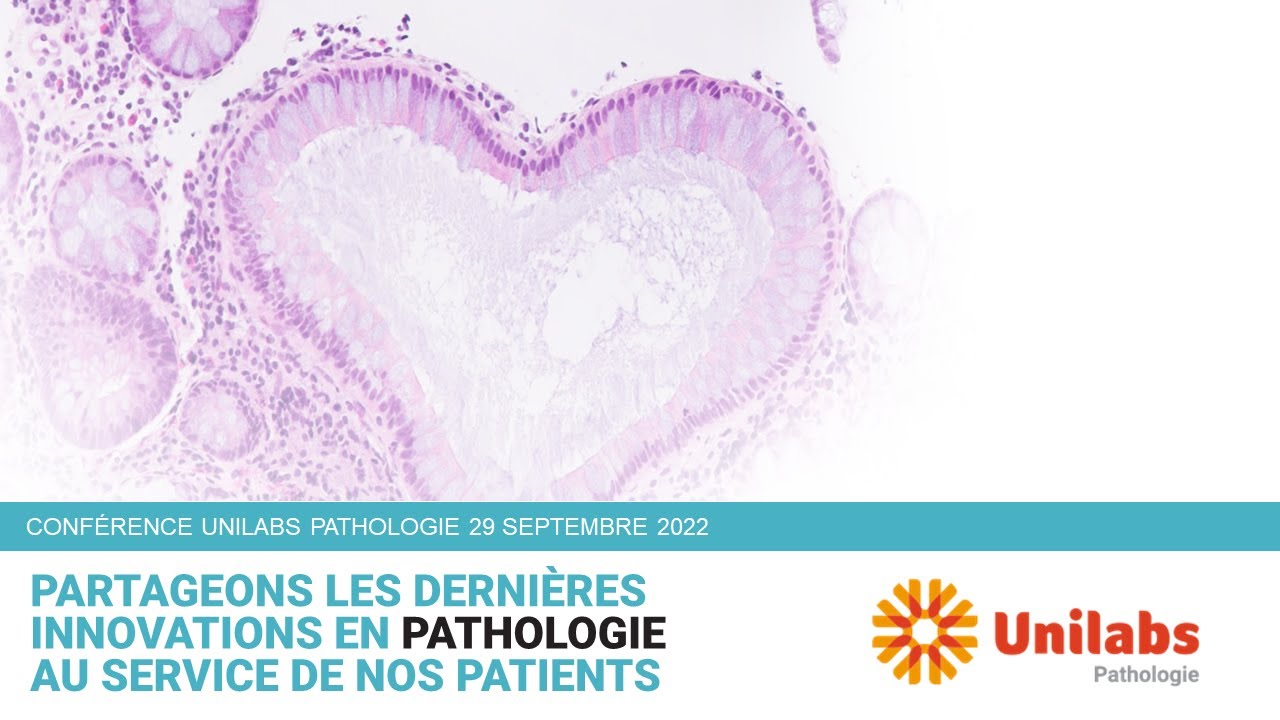 Traitement de l'HPV - impacts directs et indirects sur l'infertilité