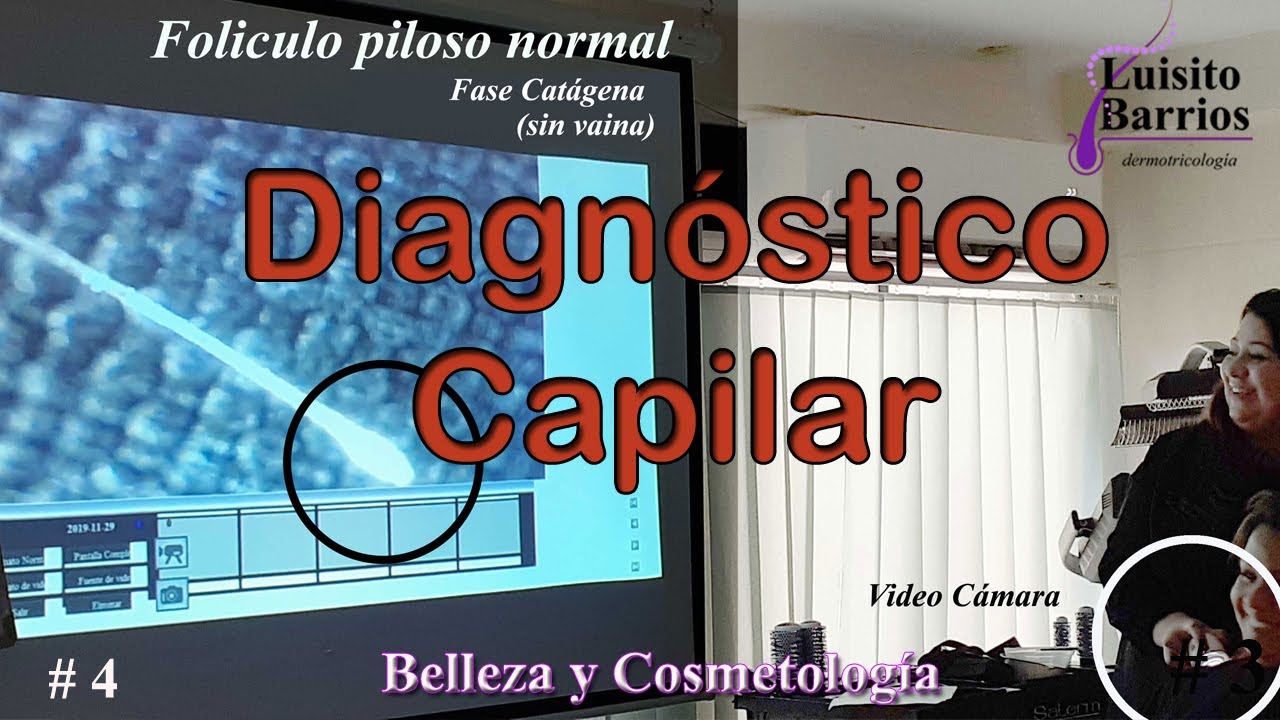 Curso Diagnóstico Capilar. video 4 de 18