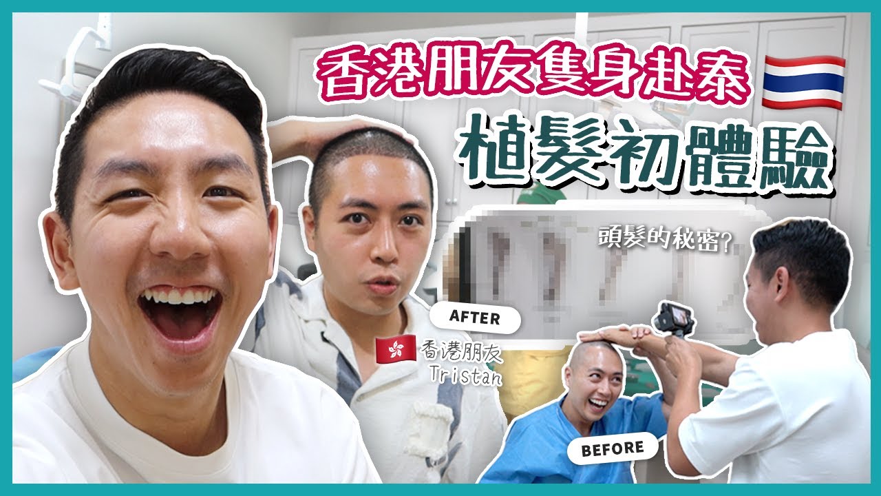 【泰國醫美】14天曼谷植髮手術之旅！拯救高髮際線禿頭危機 分享術後必備神器！ft. 