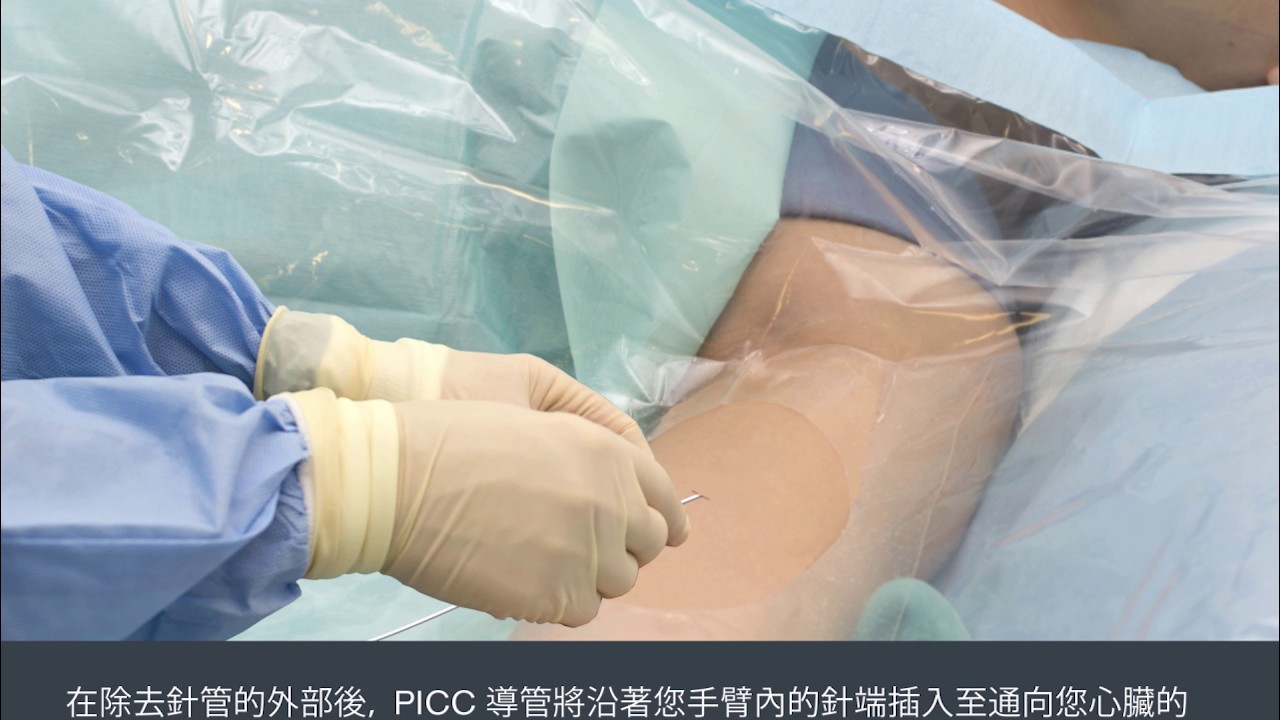 Having a Peripherally Inserted Central Catheter - PICC (Chinese) /  裝置週邊插入主靜脈導管（PICC）