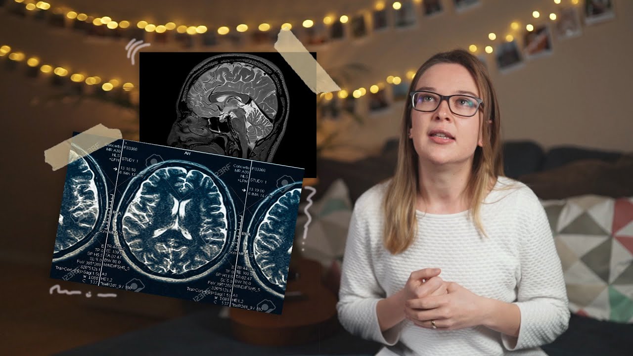 Una PARALISIS en el CEREBRO | Storytime