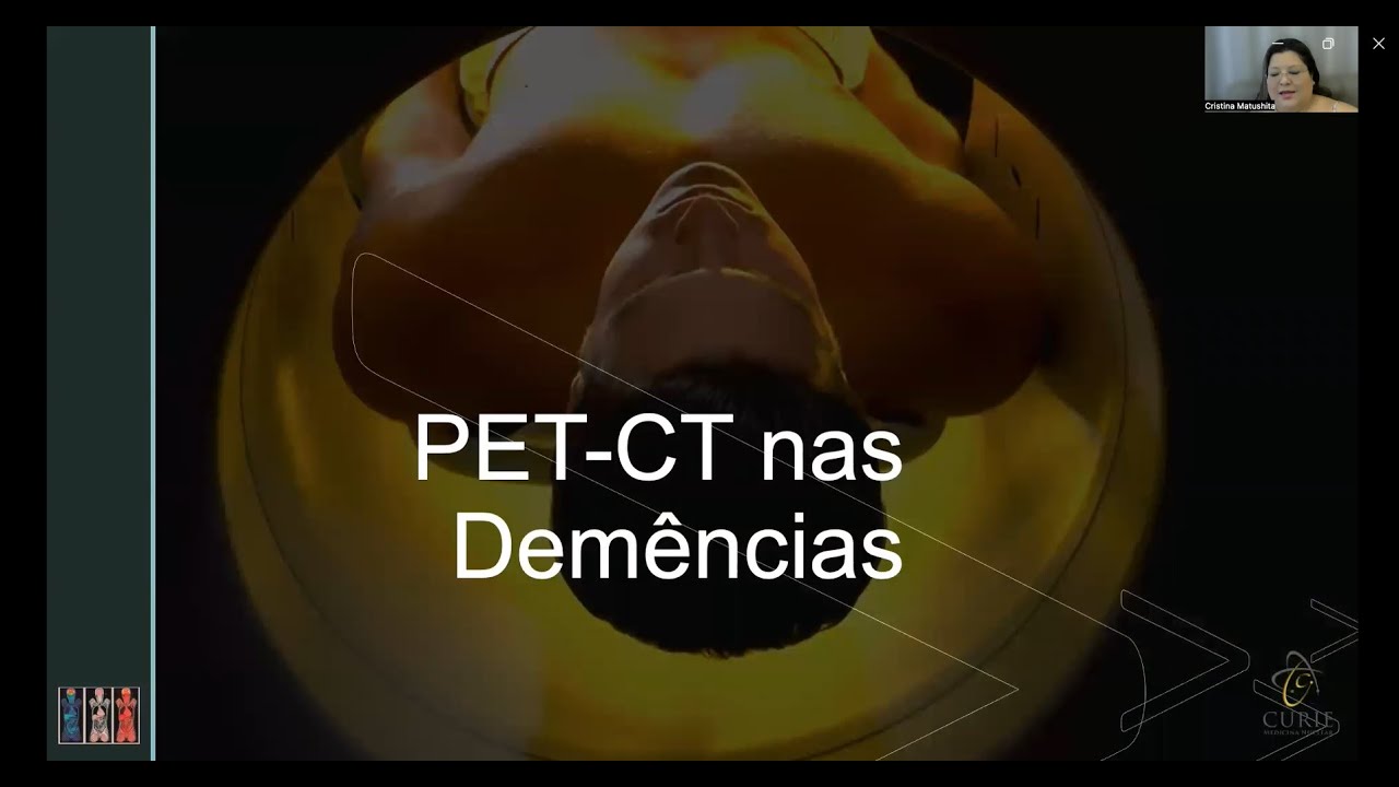 PET CT além da Oncologia 2 -   Demências