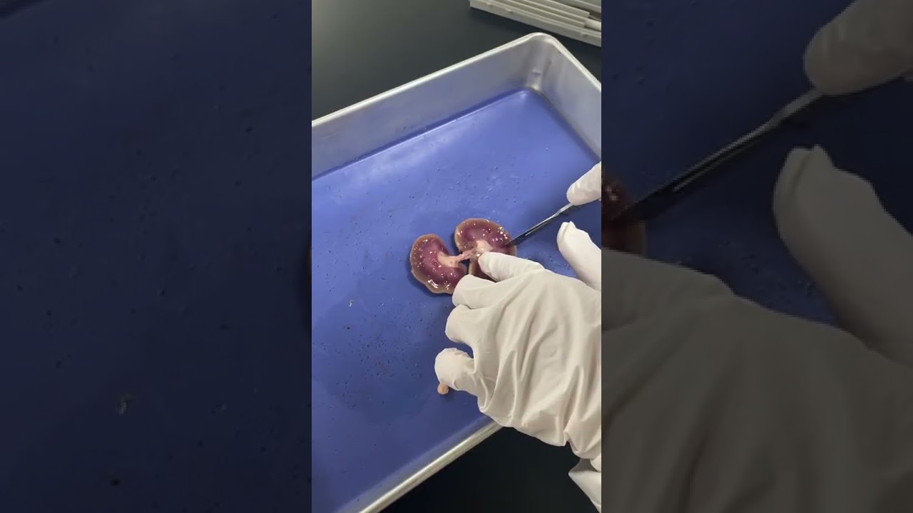 لاب اليوم تشريح الكلية (kidney dissection )،كان حلو استمتعنا 🌟#طالبة_طب #مختبرات #يوميات #تشريح