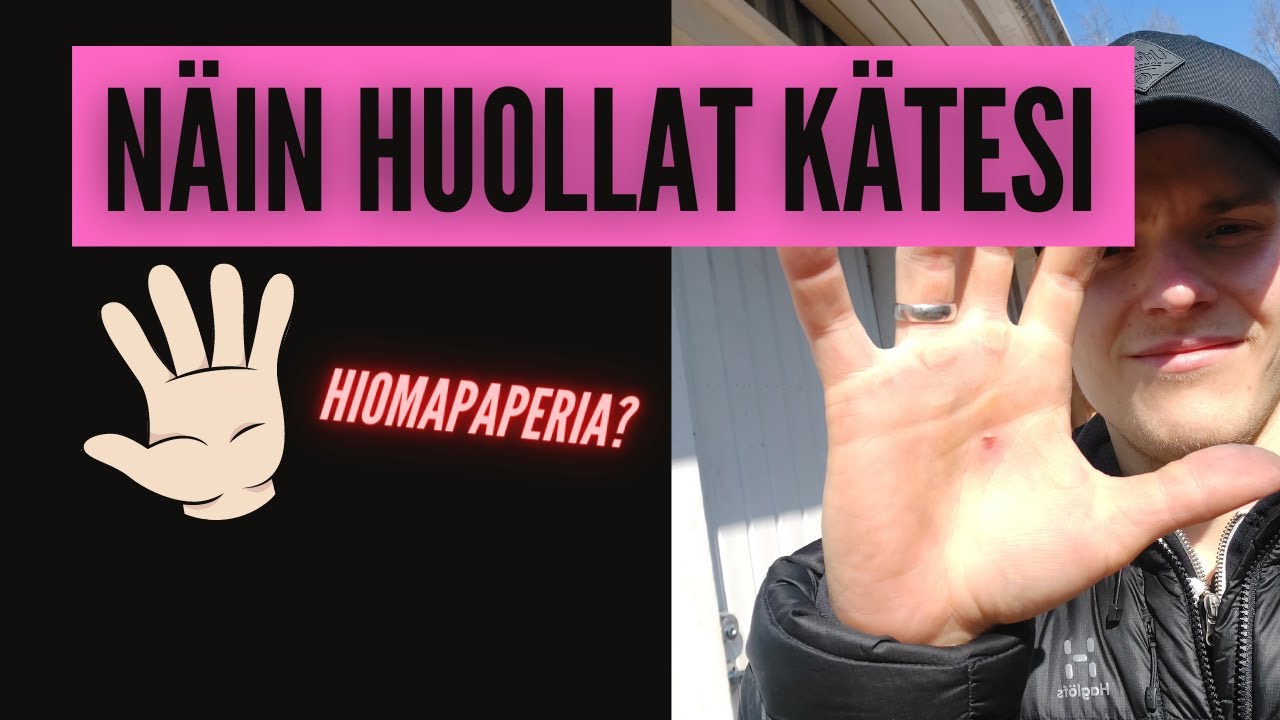 K&auml;sien huoltaminen | N&auml;in huollat kovettumat