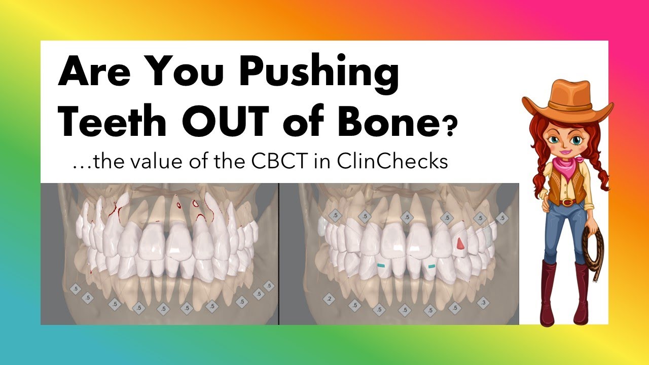 Invisalign ClinCheck and CBCT feature