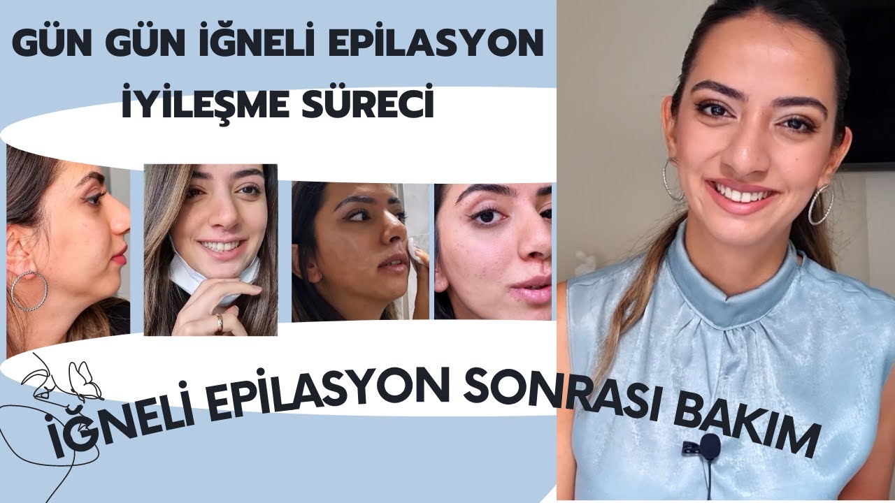 İĞNELİ EPİLASYON İYİLEŞME SÜRECİ | İĞNELİ EPİLASYON SONRASI BAKIM İZ KALIR MI? YÜZ TÜYLERİ KURTULMA