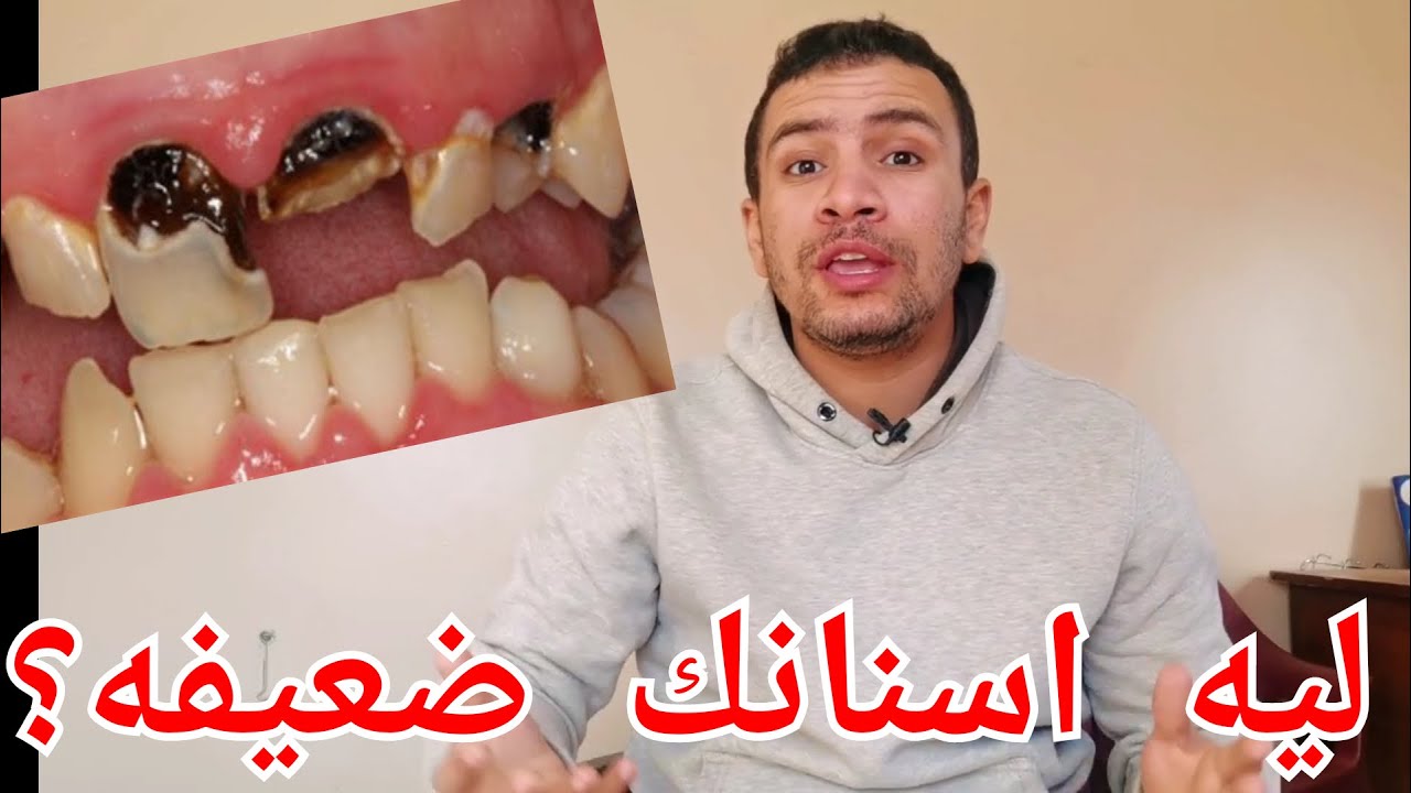 5 اسباب تجعل اسنانك ضعيفه و عرضه للكسر تعرف عليها
