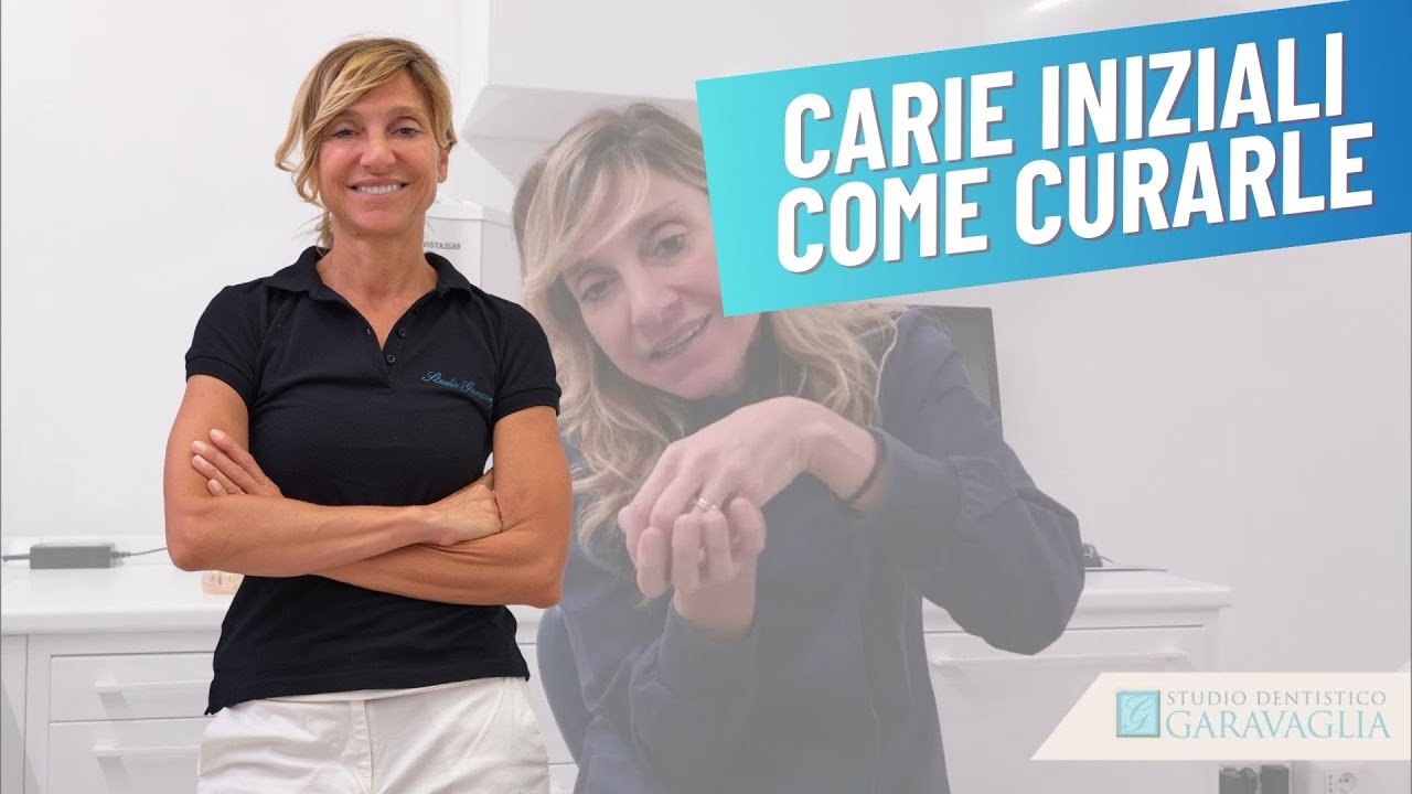 Carie allo stato iniziale - Carie Reversibile