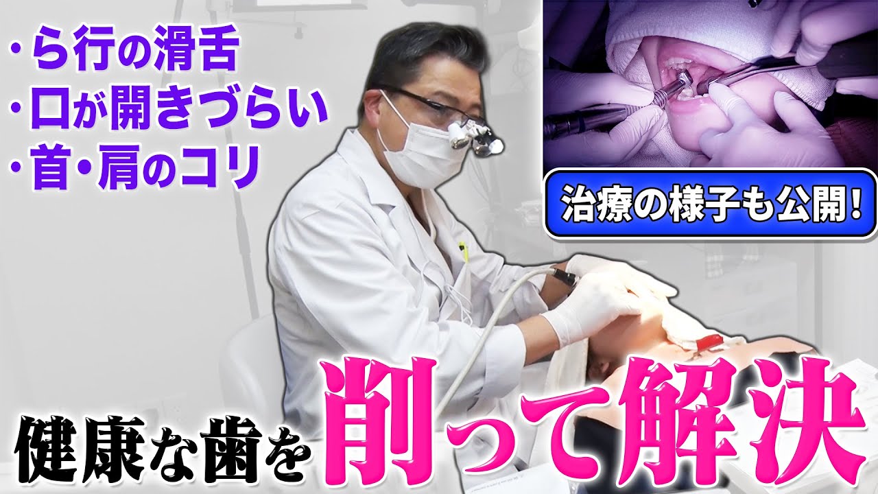 【劇的変化】放っておくと舌ガンの可能性も！？健康な歯を削る治療法を公開　〜安藤歯科クリニック〜