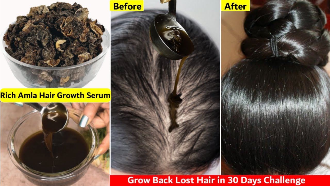 काले घने लम्बे बालों के लिए👆🏼रोज़ जड़ों में लगाएं Hair Regrowth Serum-Get Full Heavy Black Hair Growth