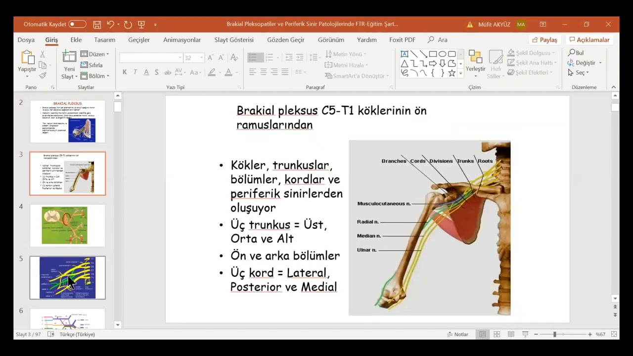 Prof. Dr. Müfit AKYÜZ ile pandemi günleri-9- 31 05 2020 Brakial Pleksus Lezyonları Müfit AKYÜZ
