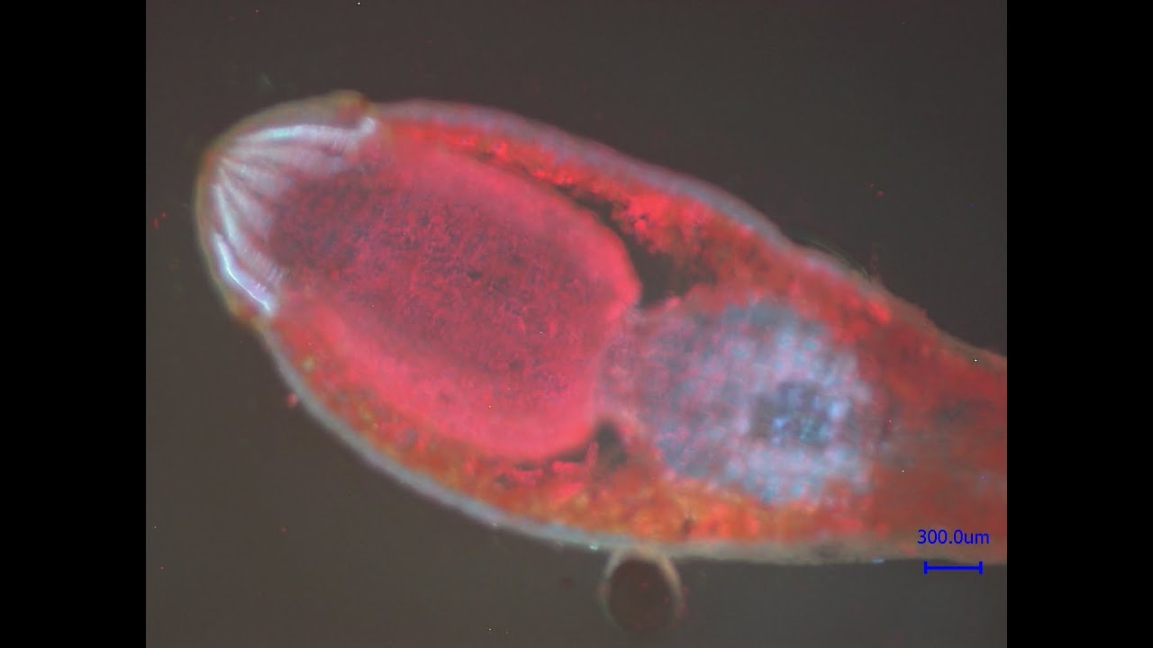 Sporogon von Funaria hygrometrica Details