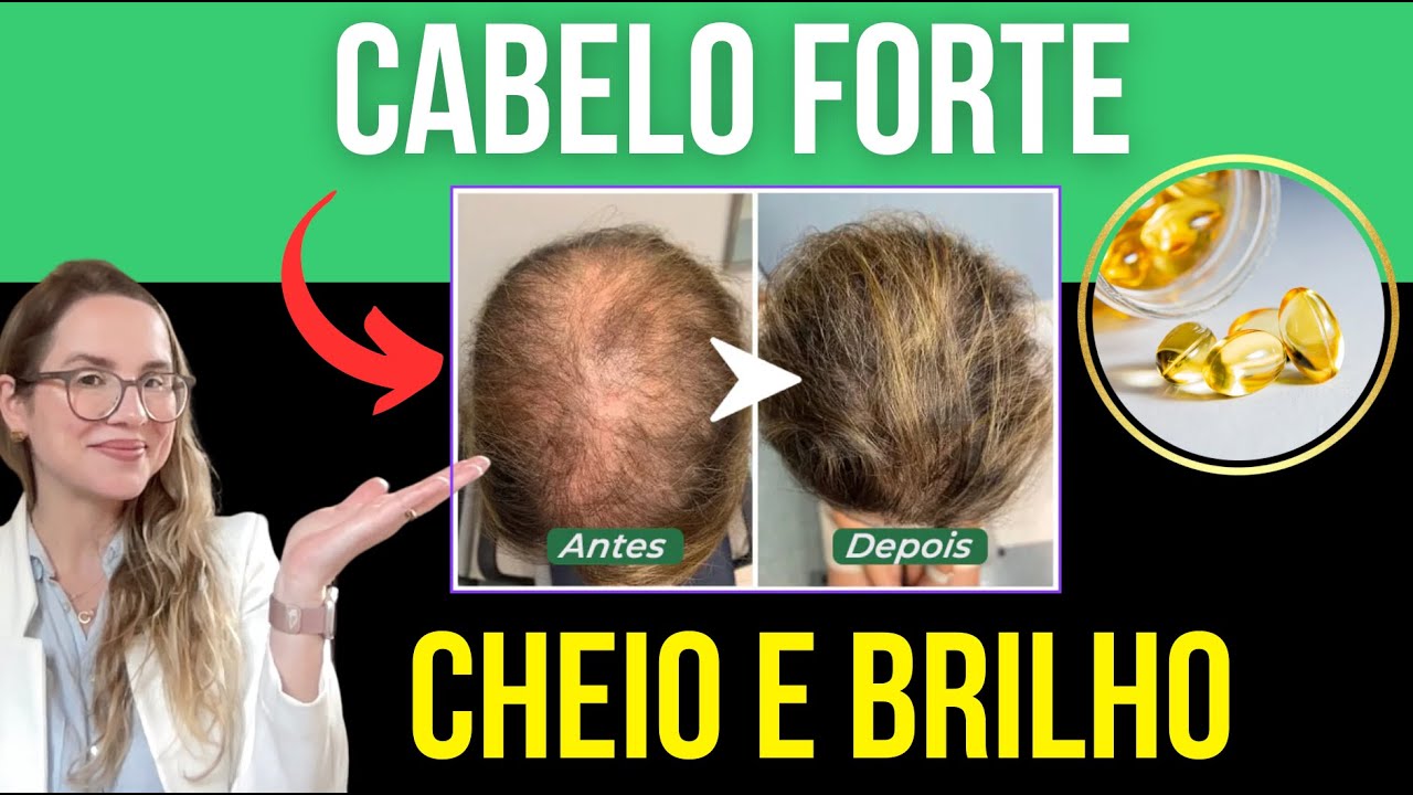 CABELO FORTE E SAUDÁVEL - 5 suplementos poderosos