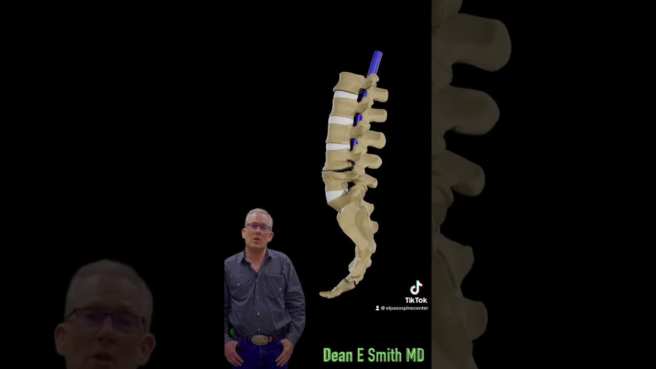 Minimally, invasive surgery, lumbar spinal stenosis