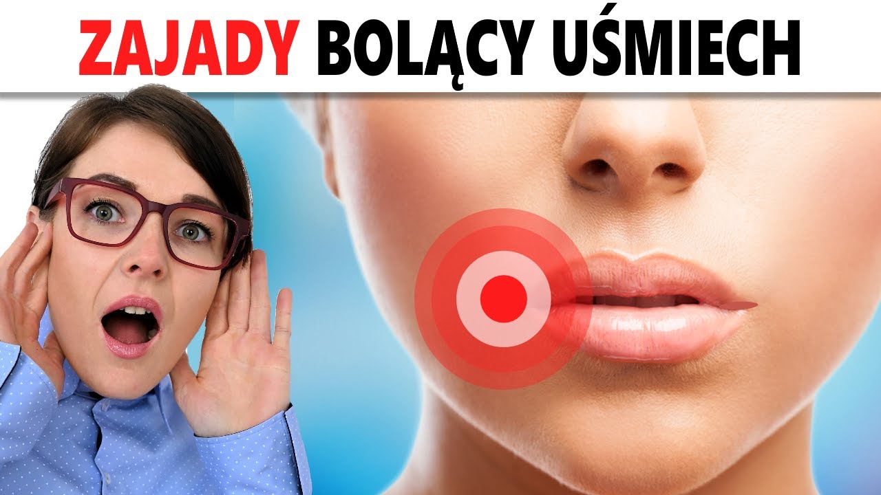 ZAJADY w Kącikach Ust. POZNAJ Szybkie Sposoby Leczenia