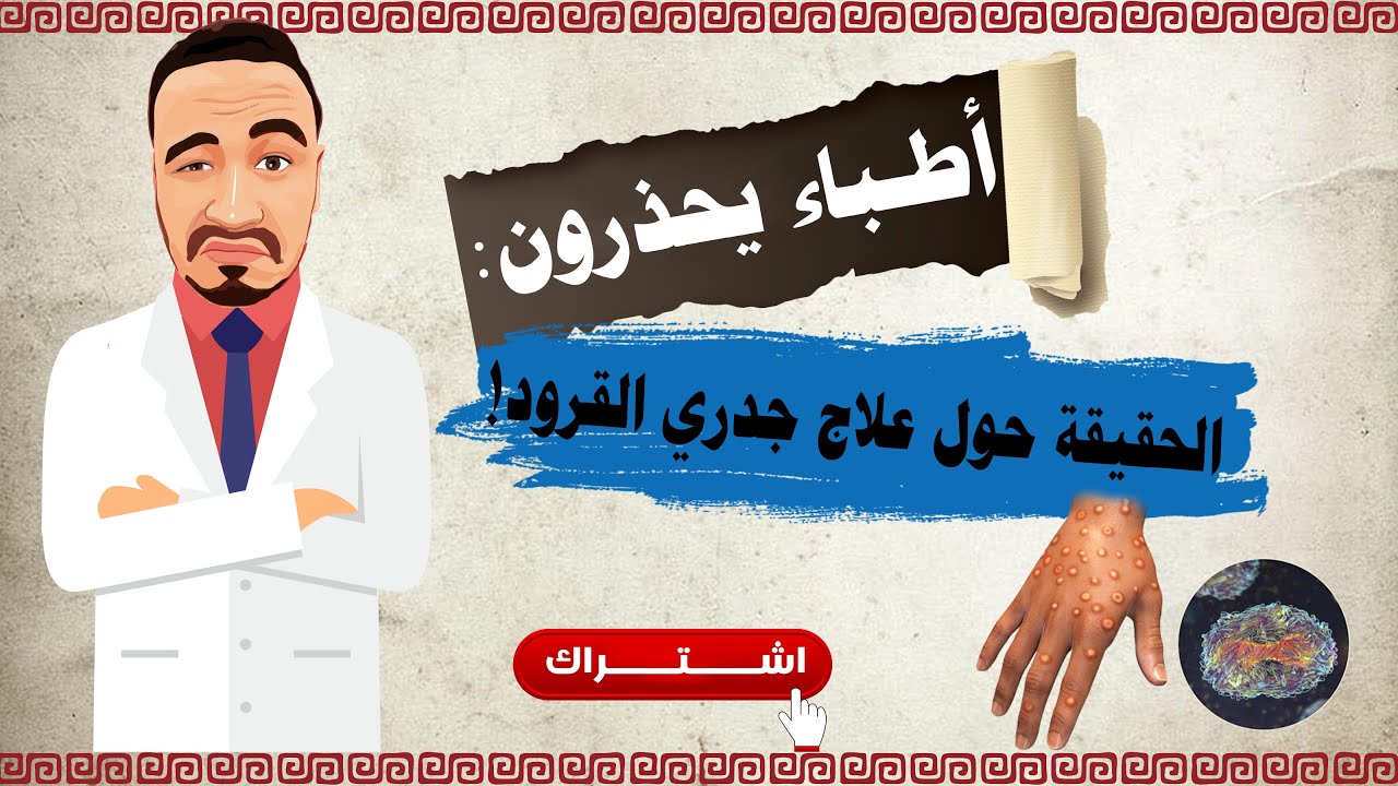 أطباء يحذرون: الحقيقة حول علاج جدري القرود!