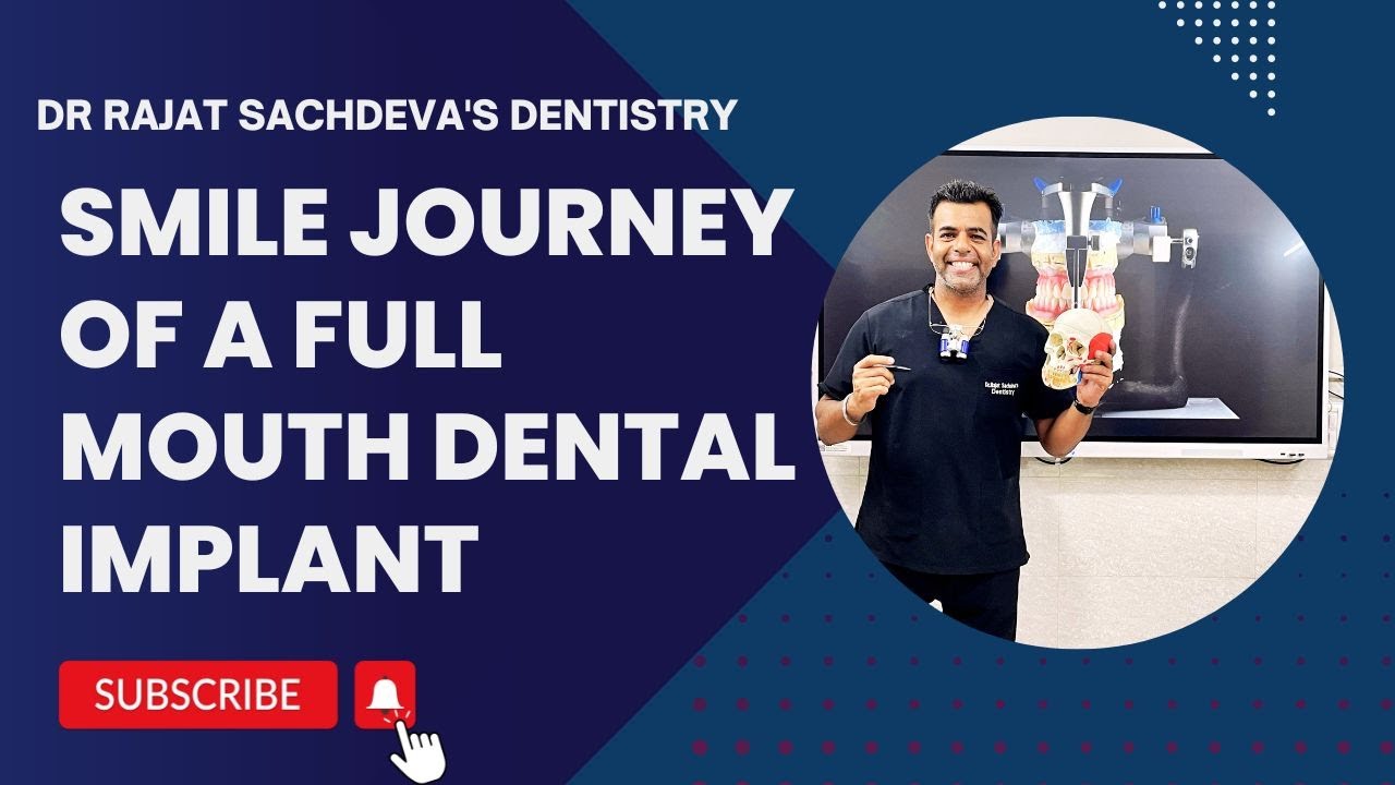 Full Mouth Dental Implants Smile Journey | Same Day Dental Implants | Dental Implants Delhi