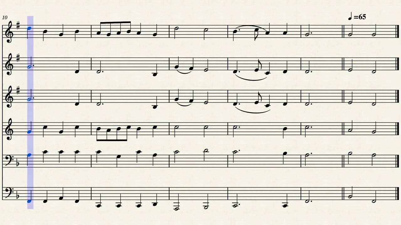 All Hail the Power of Jesus' Name (Mixed Sextet)