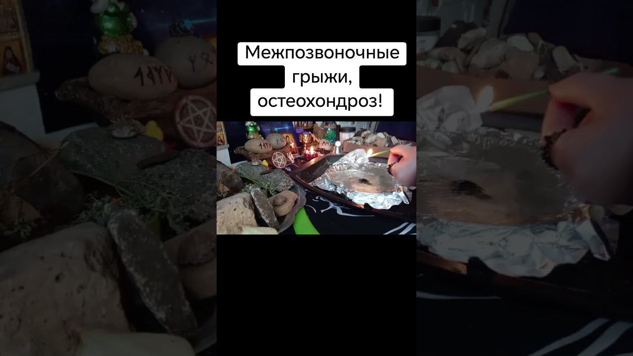 Межпозвоночные грыжи, остеохондроз! #каралепэска #целитель #остеохондроз #грыжа #межпозвоночнаягрыжа