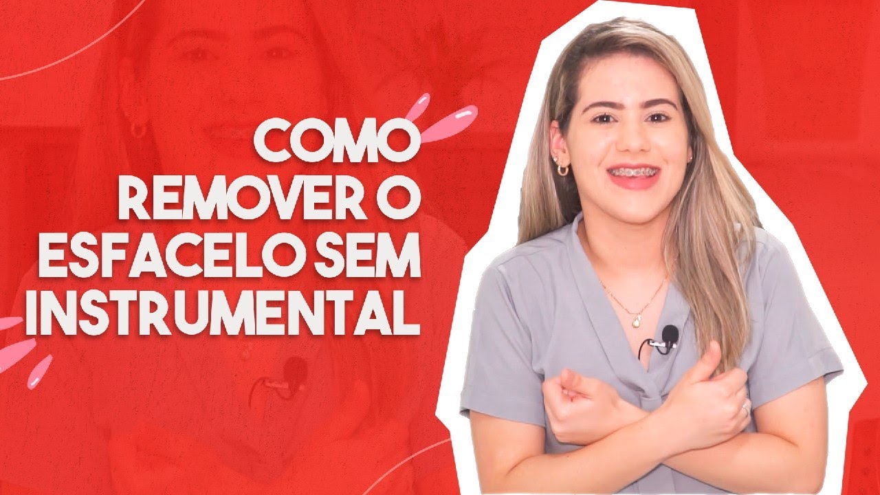 Como remover esfacelo sem instrumental cirúrgico? | Unicicatriza