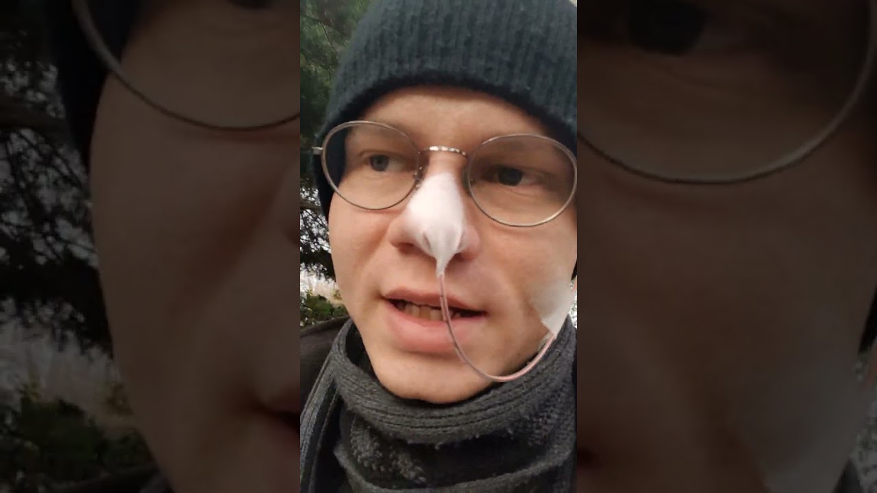 24-godzinna pH-metria z impedancją. Refluks, przełyk. Przebieg badania, wrażenia, skutki uboczne.
