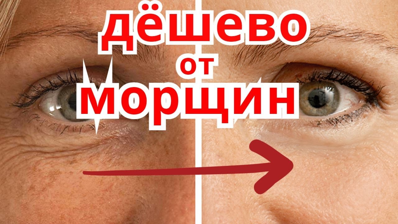 Дешёвое АПТЕЧНОЕ Средство от МОРЩИН Вокруг Глаз