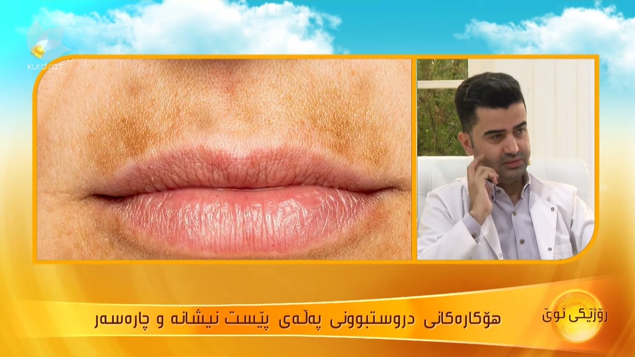 هۆكارەكانی دروستبوونی پەڵەی پێست نیشانە و چارەسەر