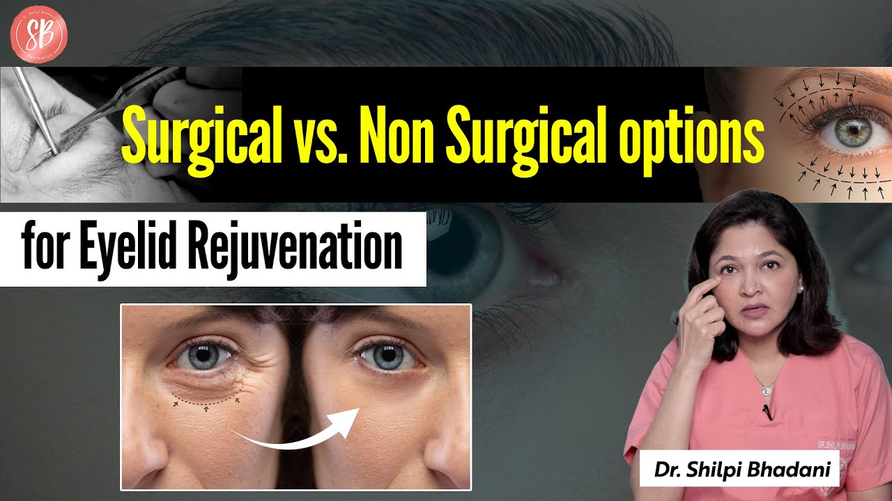 Under Eye Aging Treatment | Non Surgical Eyelid Lift | Types of Eyelid Surgery | SB Aesthetics