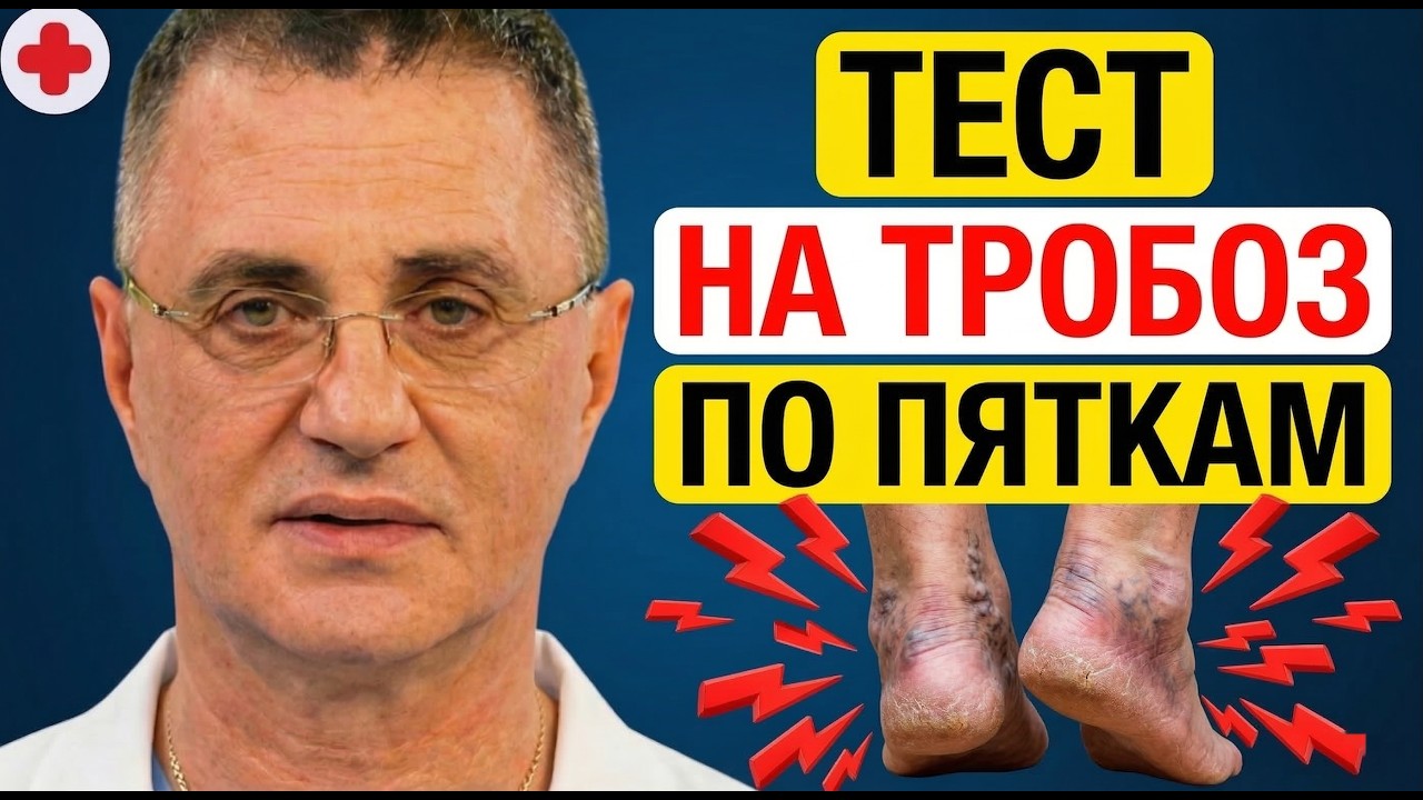 СРОЧНО проверьте ПЯТКИ! Этот признак выдает забитые сосуды! Доктор Мясников