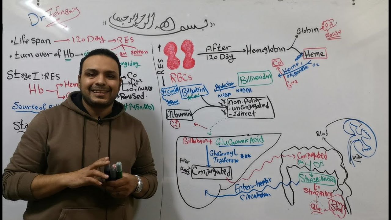 2- Heme Catabolism (Hyperbilirubinemia & Jaundice) علاج بنها