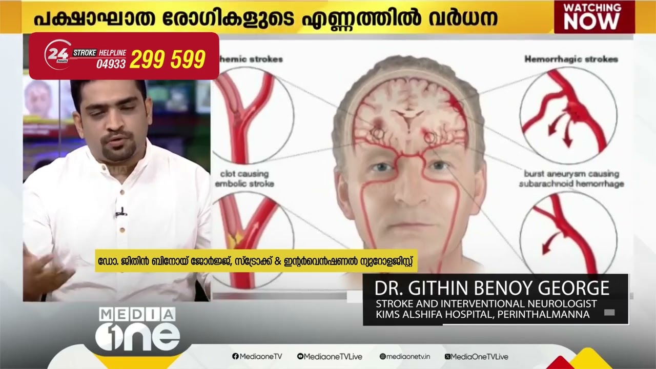 WORLD STROKE DAY | DR GITHIN BENOY GEORGE | KIMS ALSHIFA