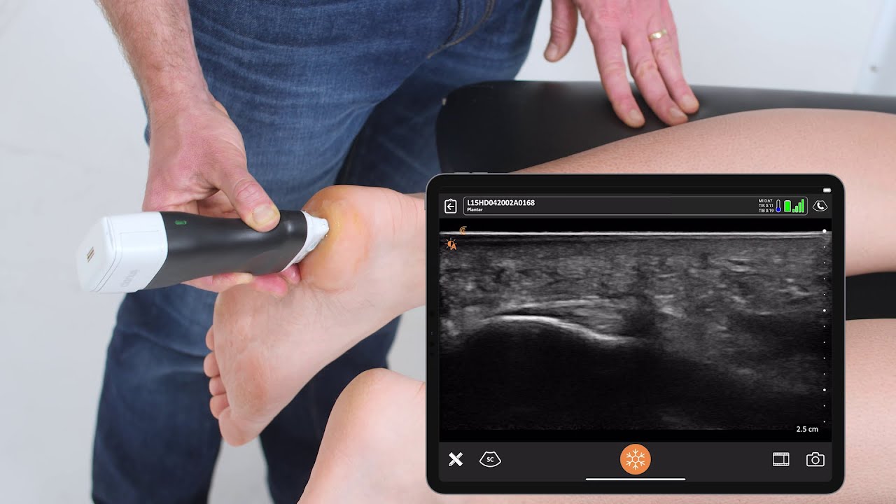How to Scan the Heel - Ultrasound Scanning Technique