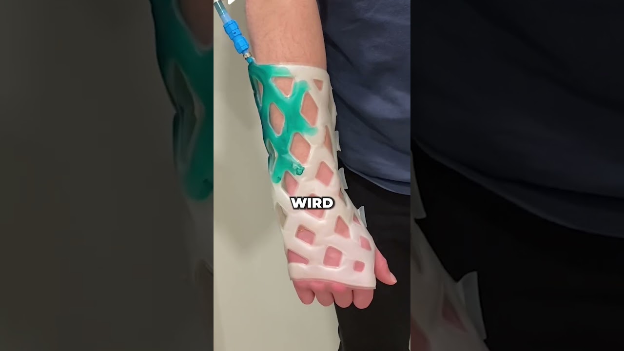 Krasse Alternative zum herk&ouml;mmlichen Gips