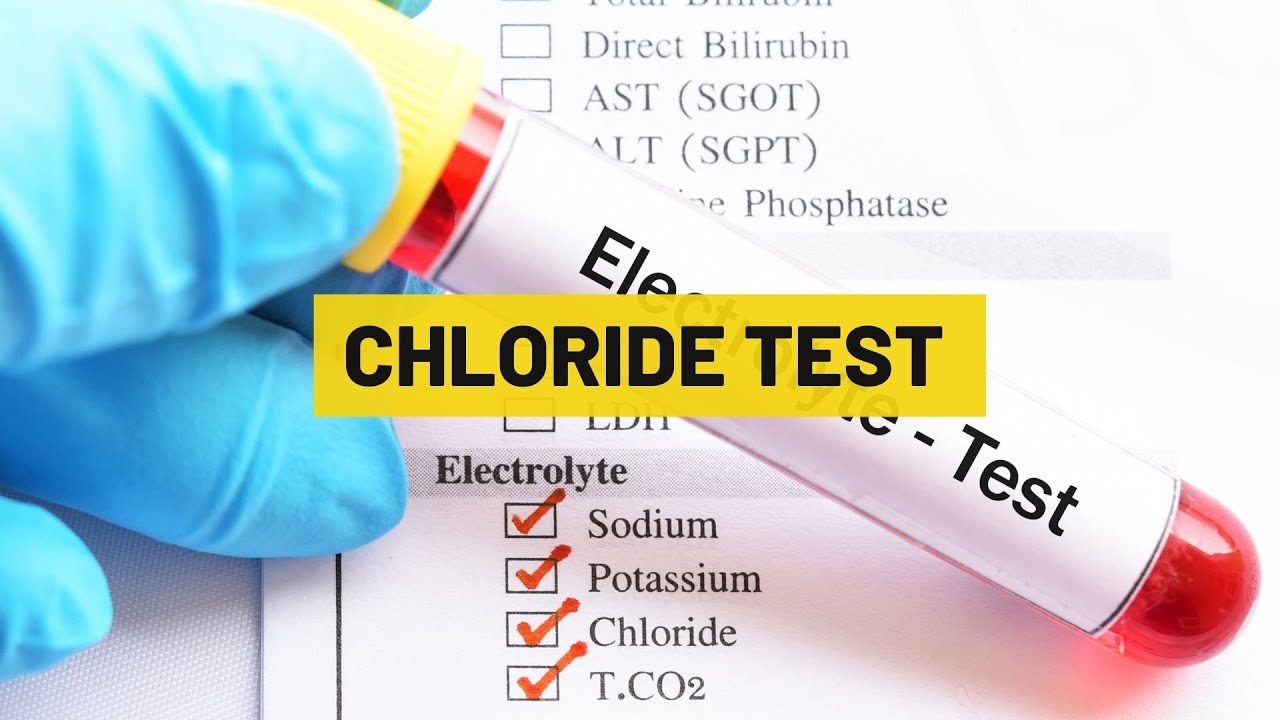 Chloride Test | My Lab Solution