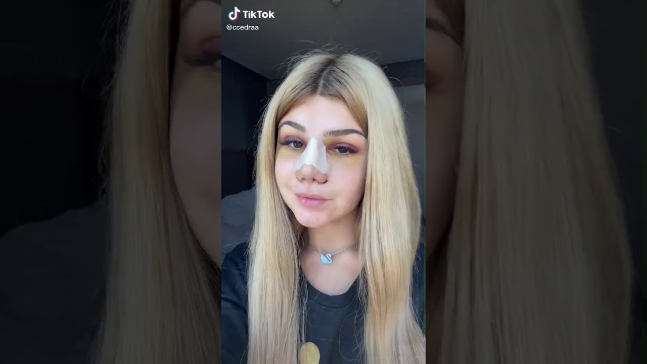 عملية تجميل الانف سيدرا بيوتي | Cedras beauty nose job 😨😨