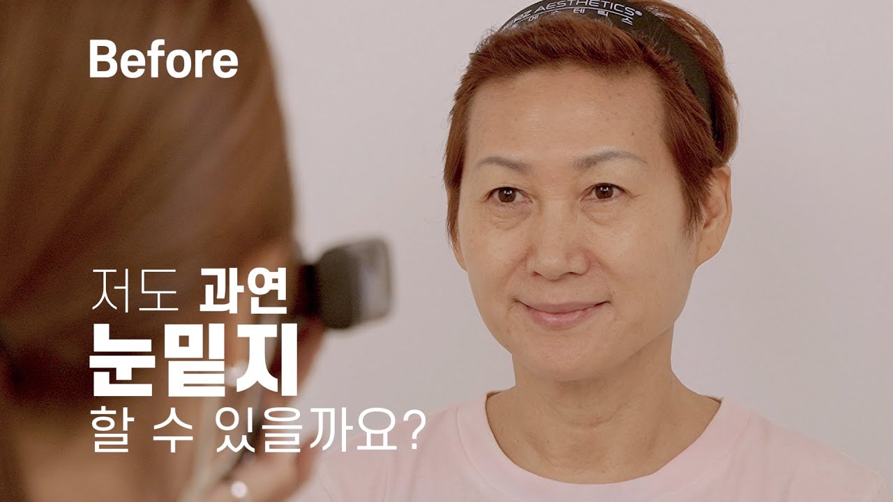 유스앤영 청담본점 - 개그우먼 임미숙님의 [눈밑지 1호가 될 순 없어]