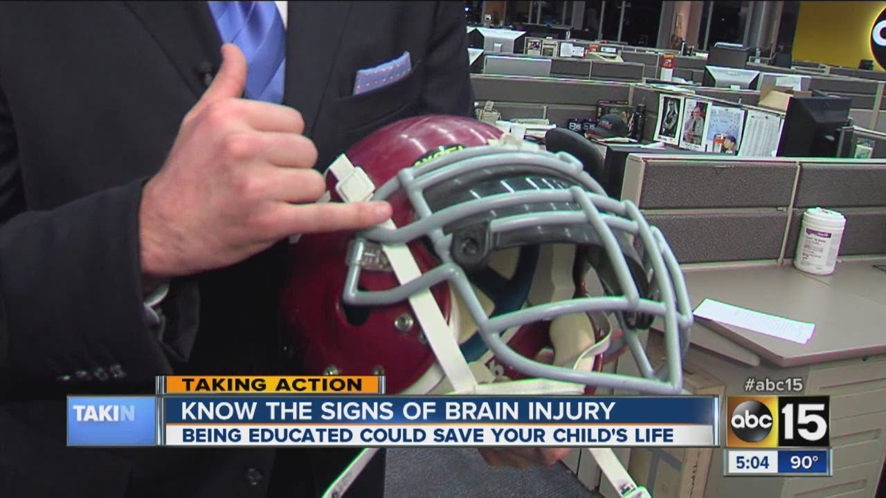 Signs, symptoms of a concussion