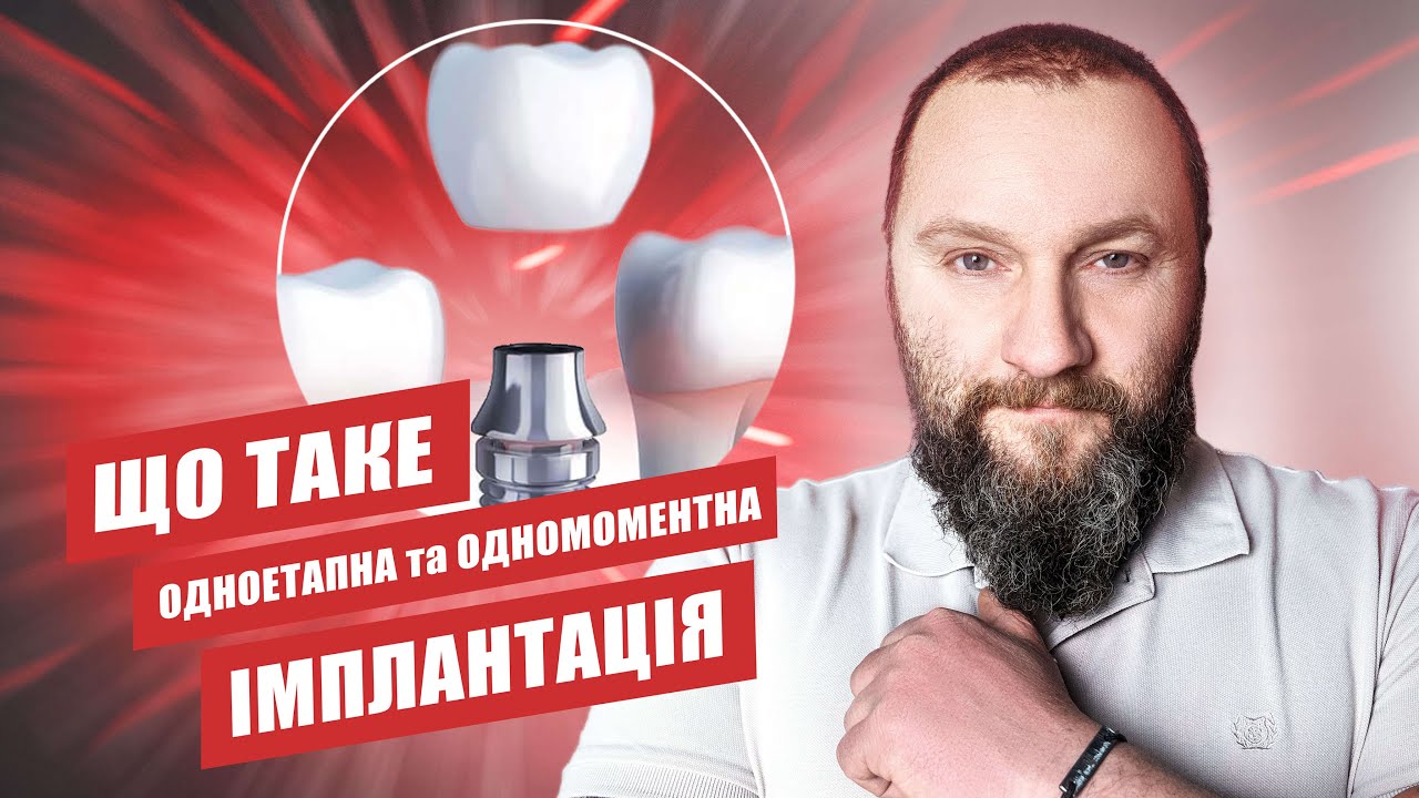 🇺🇦 Що таке одномоментна імплантація зубів