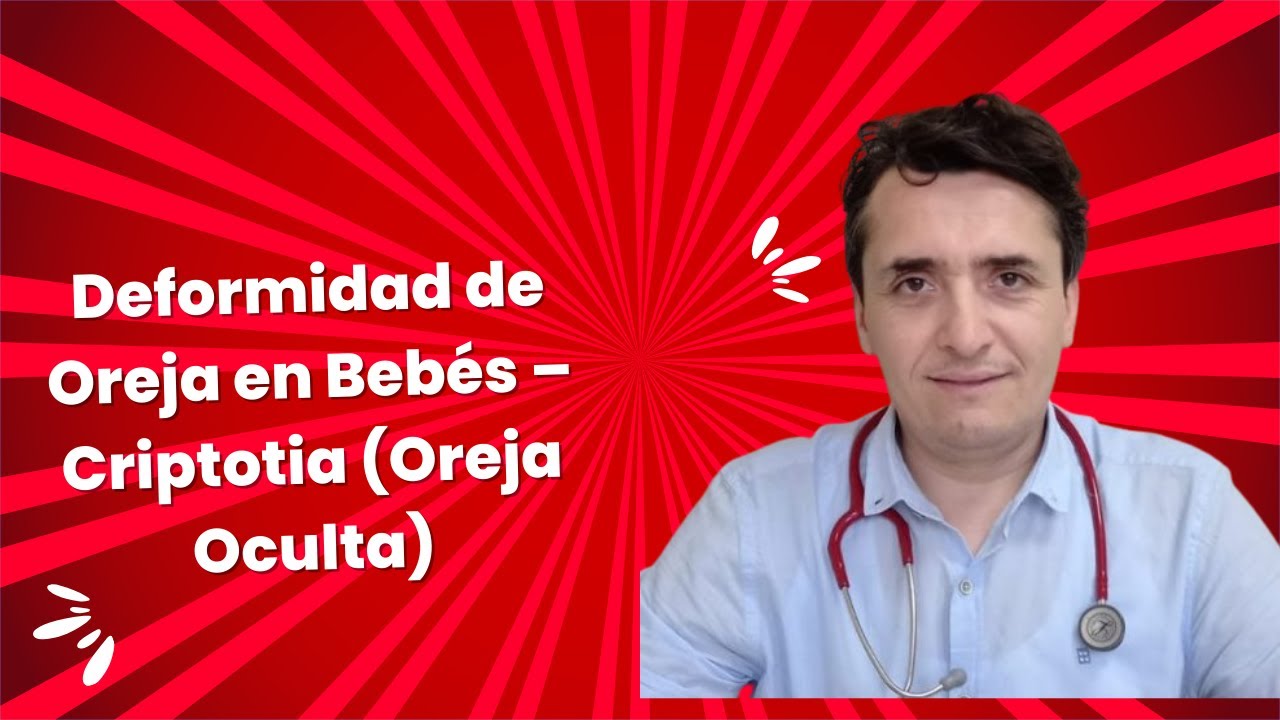 Deformidad de Oreja en Beb&eacute;s &ndash; Criptotia (Oreja Oculta)