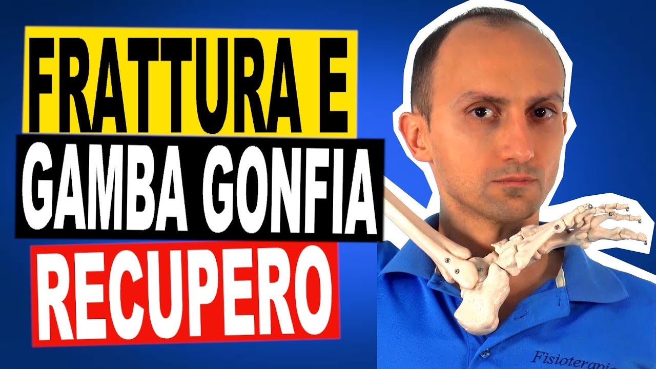 Frattura all'arto Inferiore - Favorire il Recupero