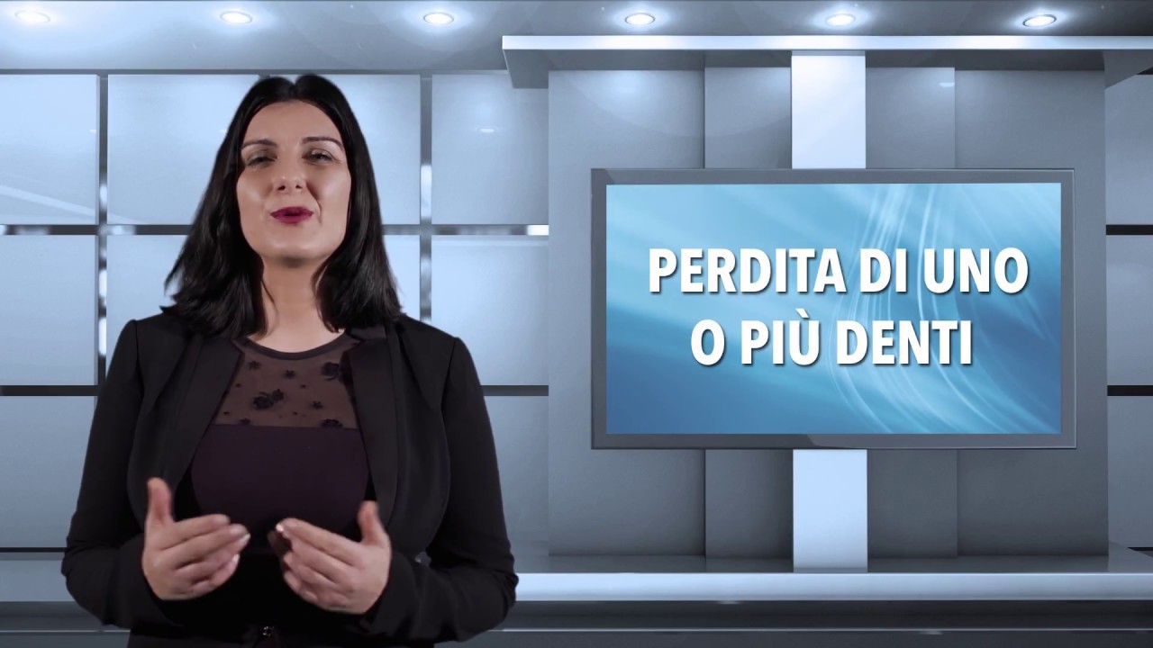 Come rimediare alla perdita di 2 o più denti