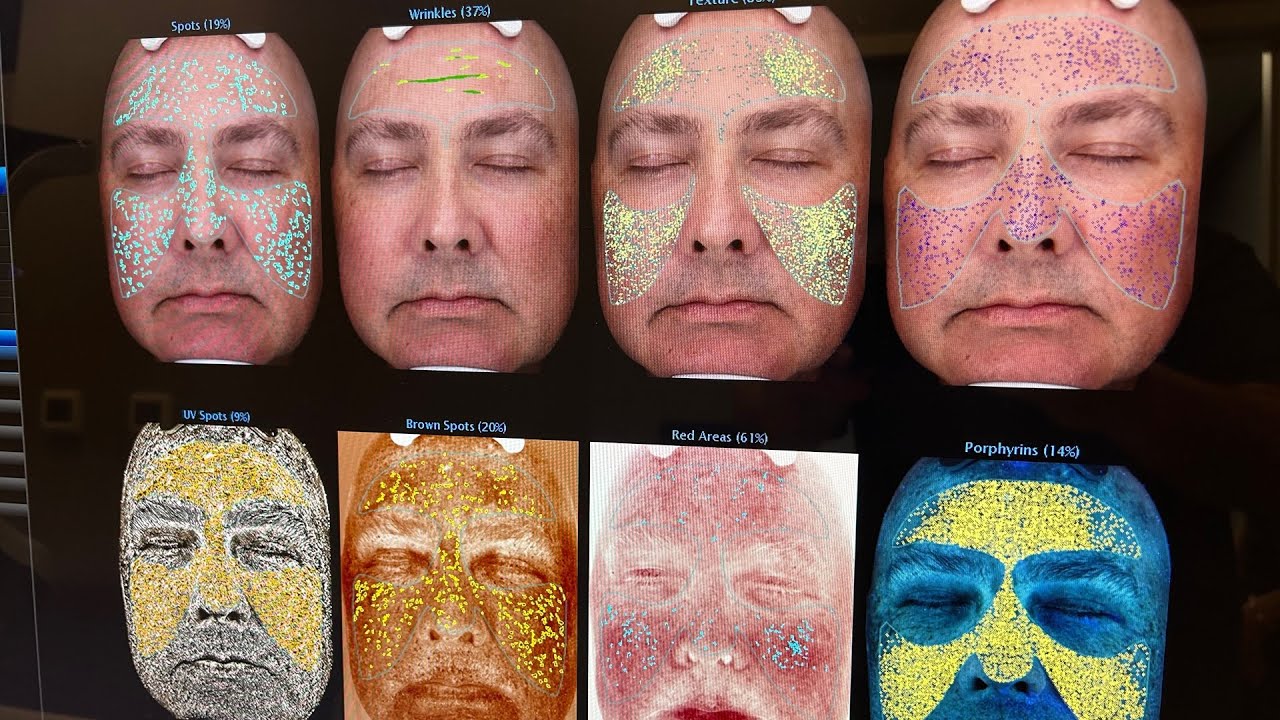 Find out what's wrong with your face and new men's wellness center
