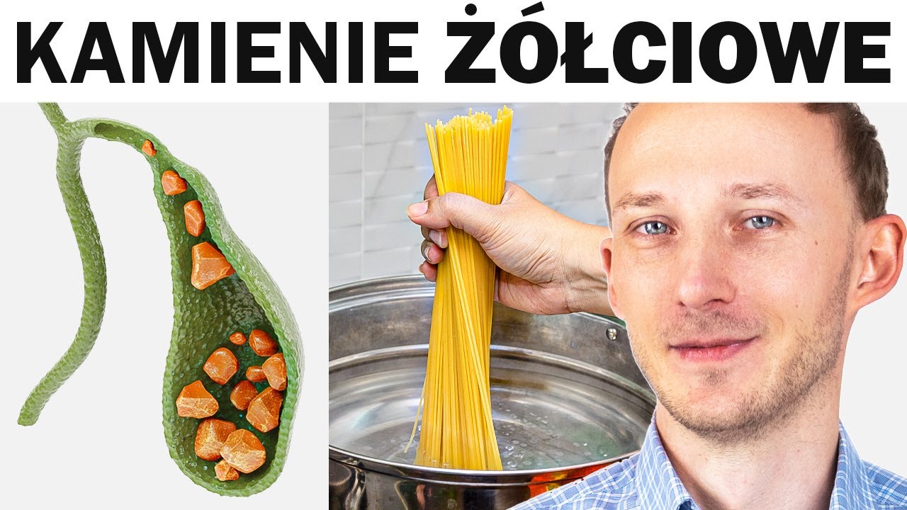 Co w diecie zatyka pęcherzyk żółciowy kamieniami?