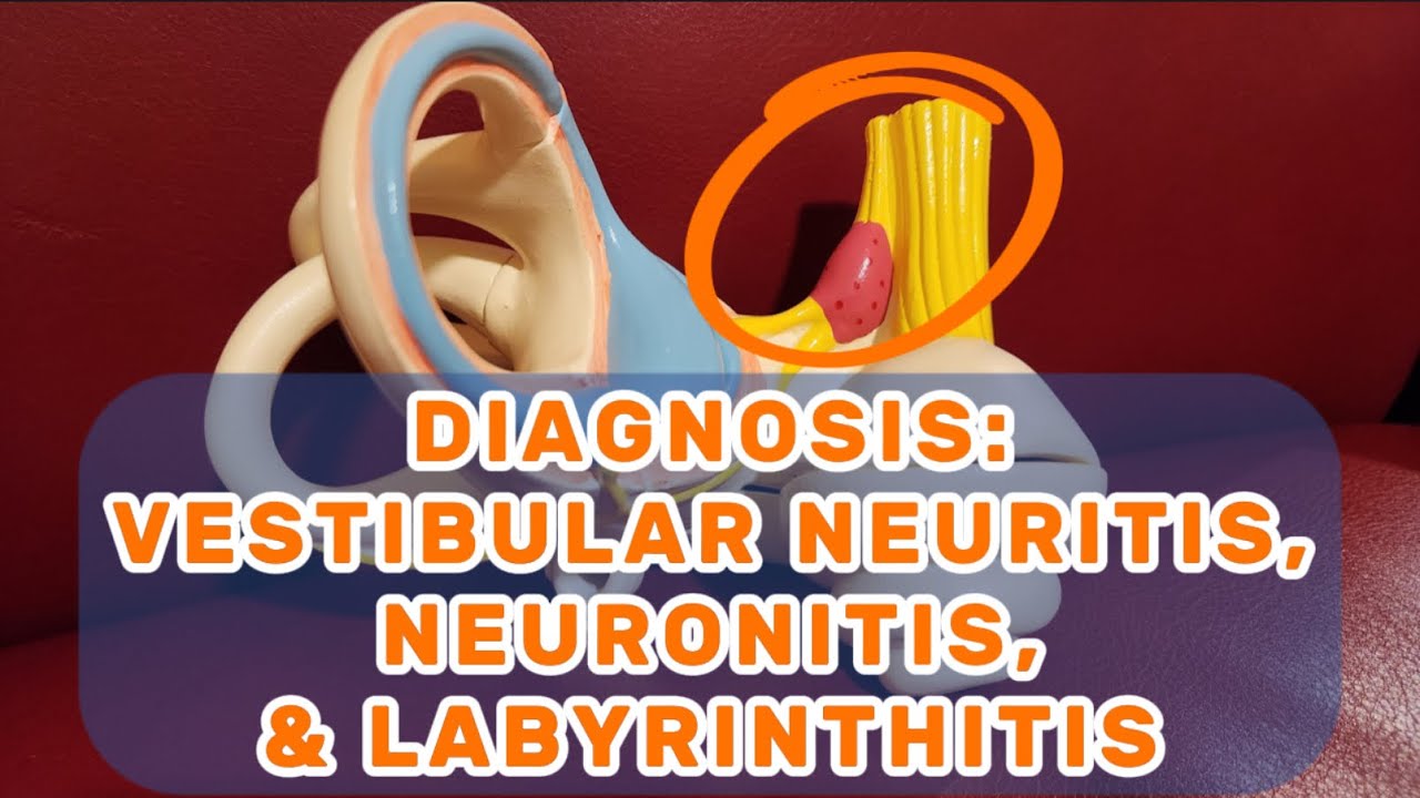 DIAGNOSIS: Vestibular Neuritis, Neuronitis, & Labyrinthitis - Dizzy Therapy