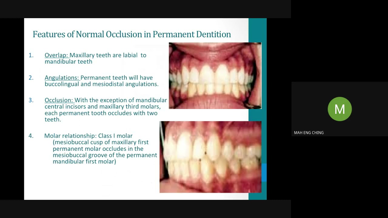 ORTHO  TUTORIAL 2
