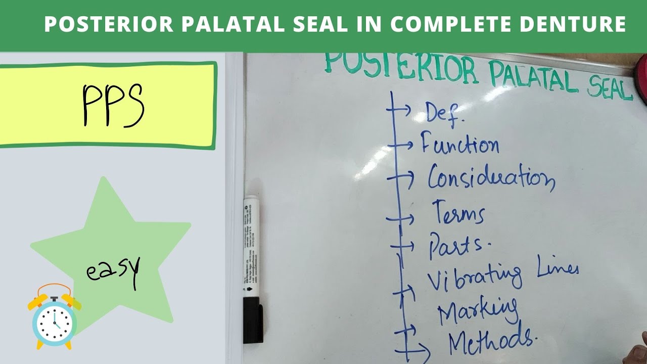 posterior palatal seal in complete denture