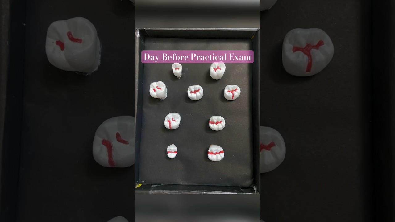 Cavity preparation | Display Box | practical exam | Conservative & Endodontics   #dentist #dental